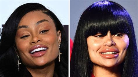 blac chyna before and after fame|Black Chynas Iconic Transformation After Reversing。